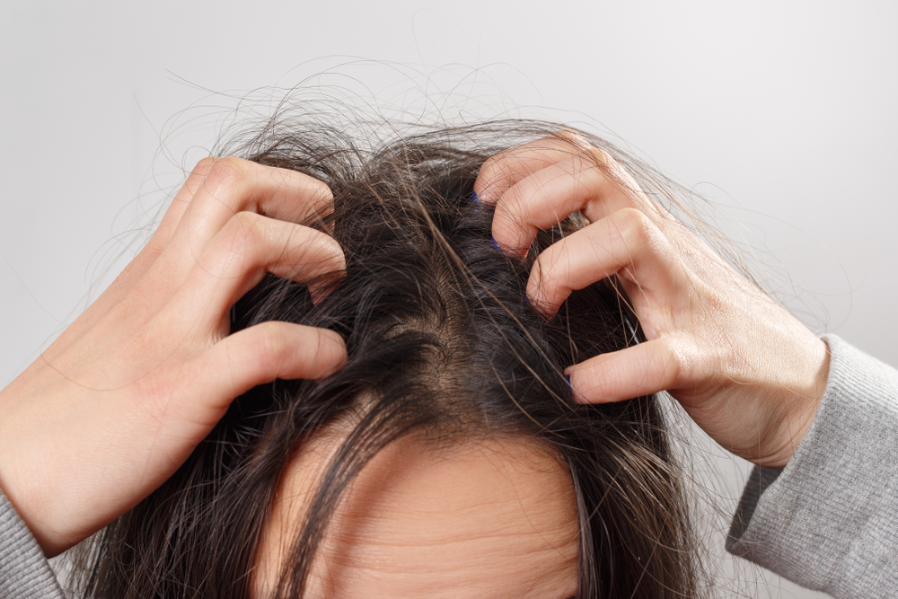 A young woman scratches her scalp and hair with her fingers. Hair health concept, scalp and hair care